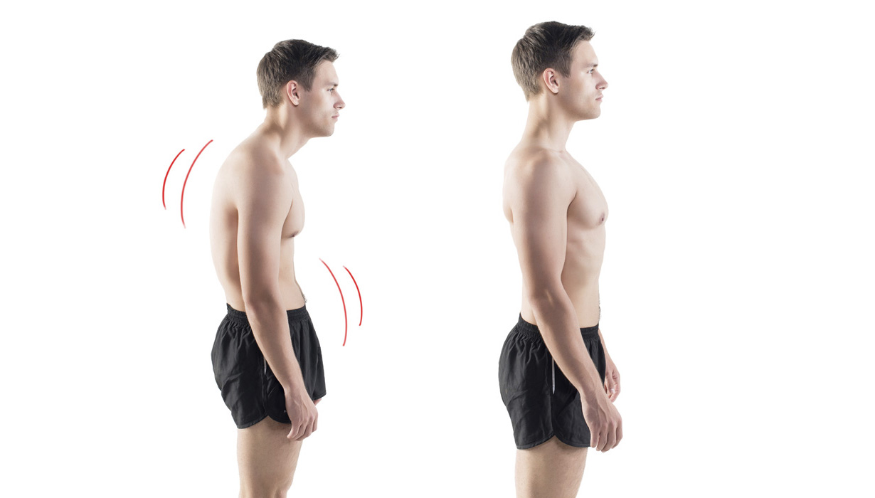 Posture Disorders